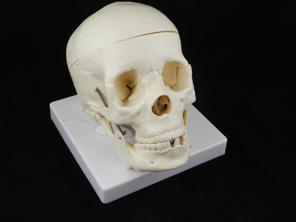 A reconstruction of a human skull having it`s internal bits by manufacturer Botox.