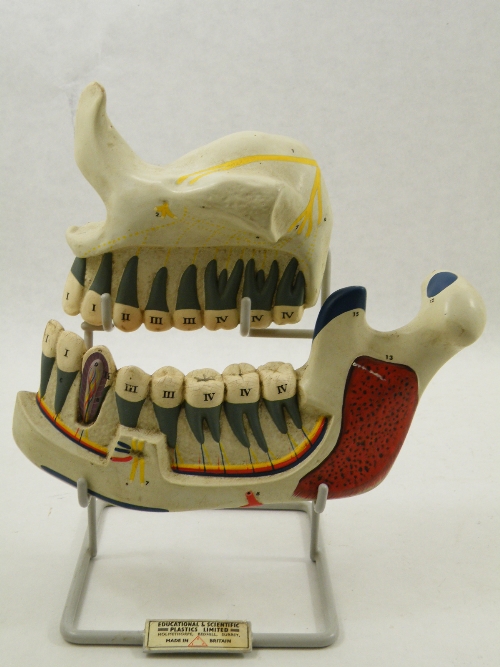 Anatomical  interest: A mid 20th Century teaching model of the human upper and lower jaw and teeth -