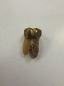 A gold mounted tooth