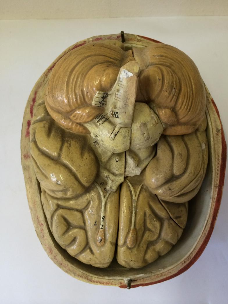 Vintage C1950 Anatomical Brain And Part Skull Model : For Condition Reports and to BID LIVE please