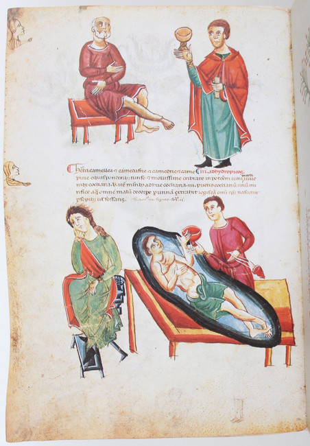 Medicina antiqua. Faks. 2 Bde.
Faksimiles. - Medicina Antiqua. Libri quattuor medicinae. Codex