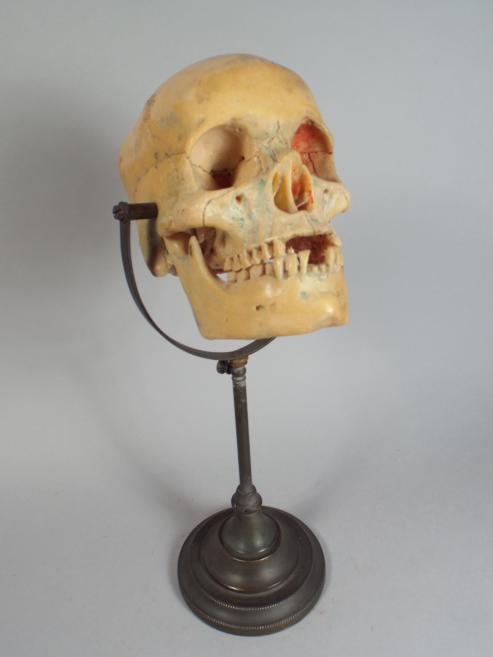An Early 20th Century Doctors Model of a Life Size Human Skull Supported on a Metal Stand.