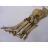 Human Articulated Foot (Originally Sourced Via Lambeth Hospital)