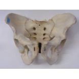 Human Pelvis Bone (Originally Sourced Via Lambeth Hospital)