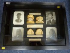 Display case and contents of 'before and after' dental moulds,