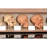 A 1920s or later educational display group of five painted composite skulls each titled as follows