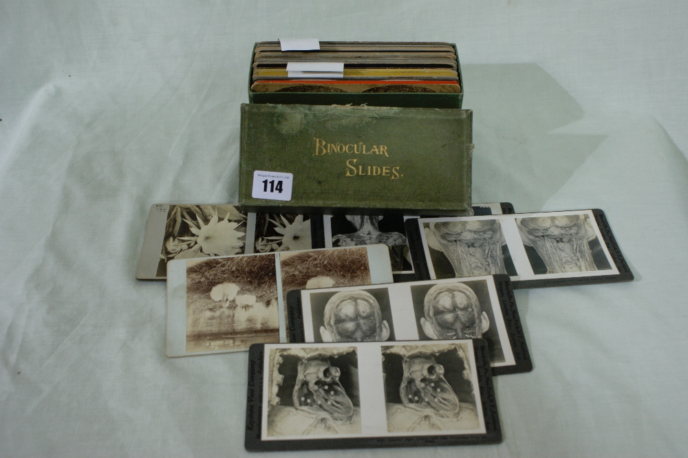 A Parcel Of Approximately 55 Stereoscope Cards, Medical, Nature And English Views