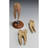 A mid-20th Century composition dentist's sectional display model of a tooth, supported on a turned