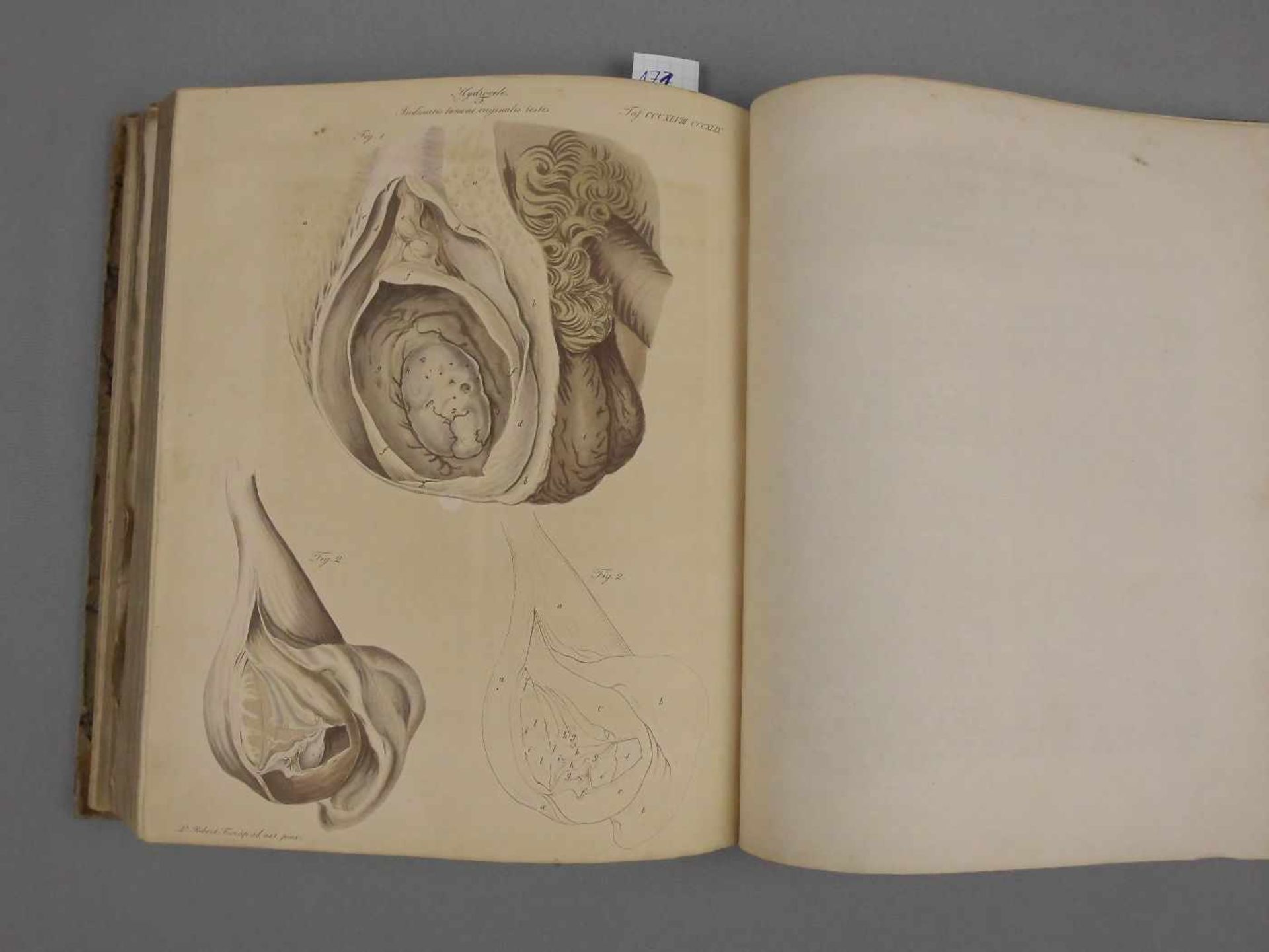 MEDIZINISCHES LEHRBUCH VON 1826 MIT CHIRURGISCHEN KUPFERTAFELN / medical book: "Chirurgische - Image 3 of 14