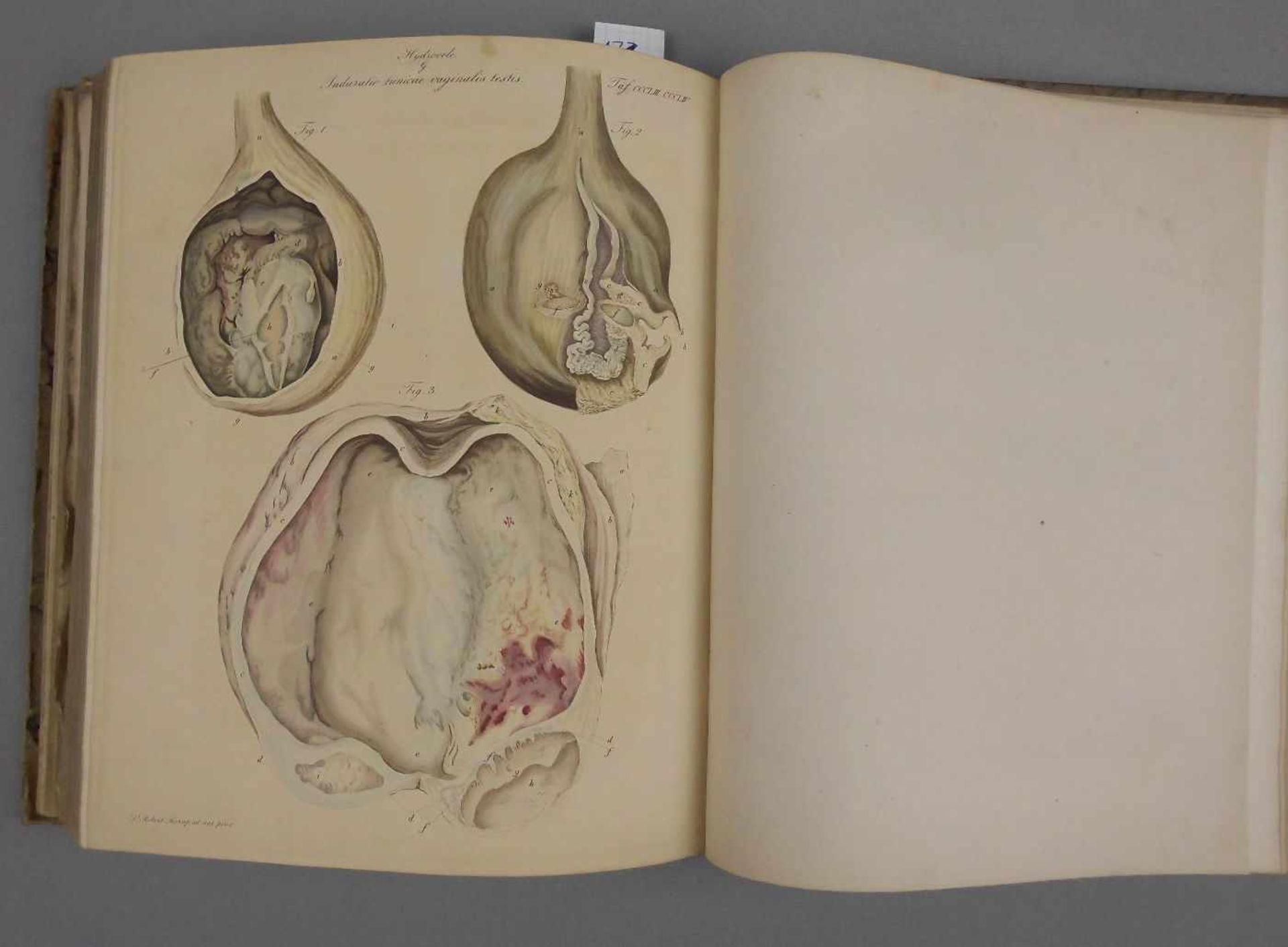 MEDIZINISCHES LEHRBUCH VON 1826 MIT CHIRURGISCHEN KUPFERTAFELN / medical book: "Chirurgische - Image 4 of 14