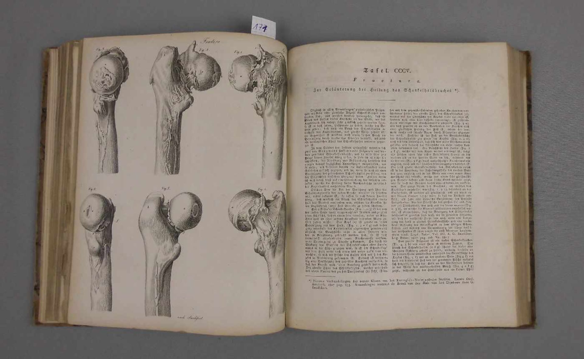 MEDIZINISCHES LEHRBUCH VON 1826 MIT CHIRURGISCHEN KUPFERTAFELN / medical book: "Chirurgische - Image 13 of 14