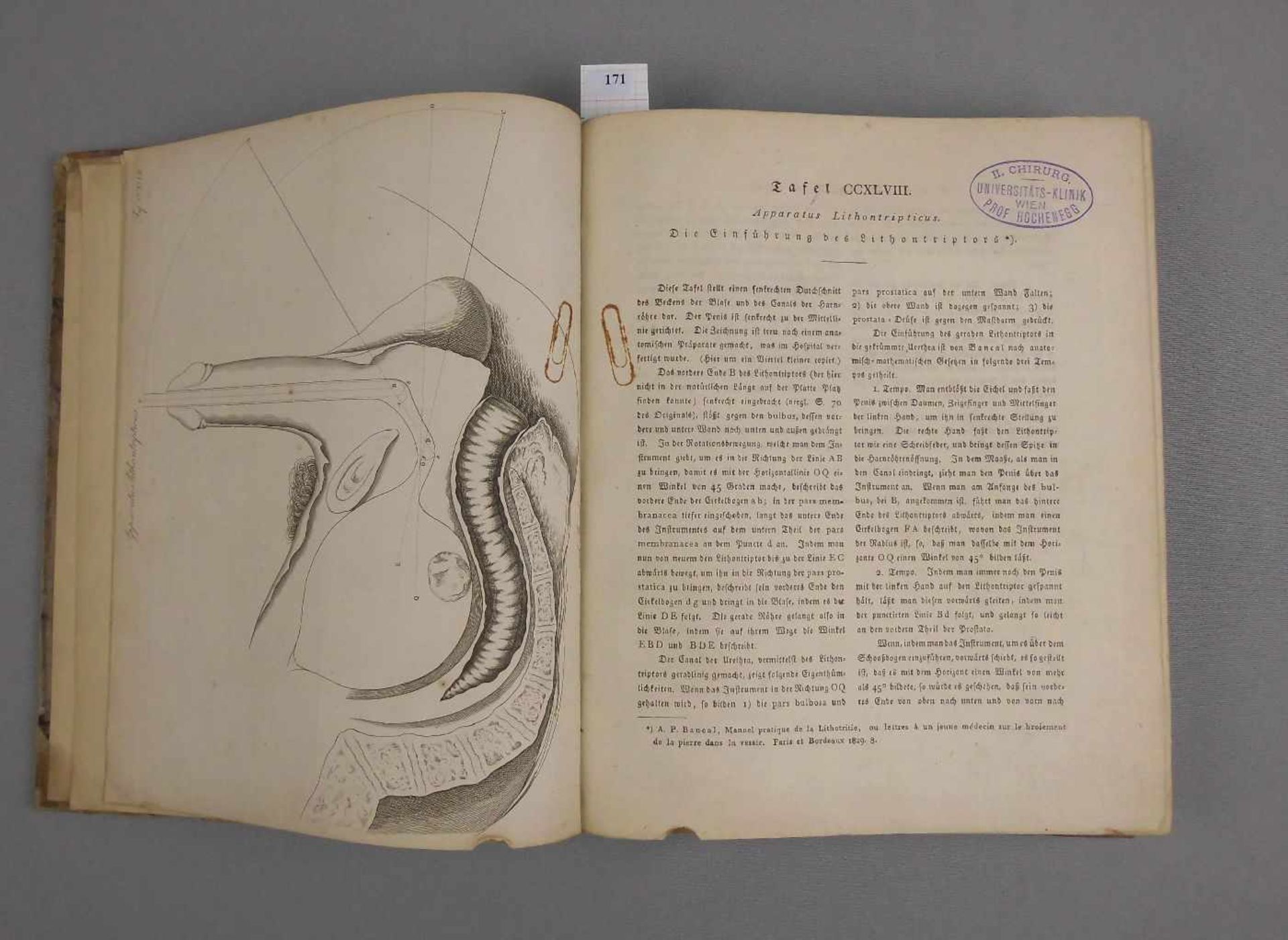 MEDIZINISCHES LEHRBUCH VON 1826 MIT CHIRURGISCHEN KUPFERTAFELN / medical book: "Chirurgische - Image 11 of 14