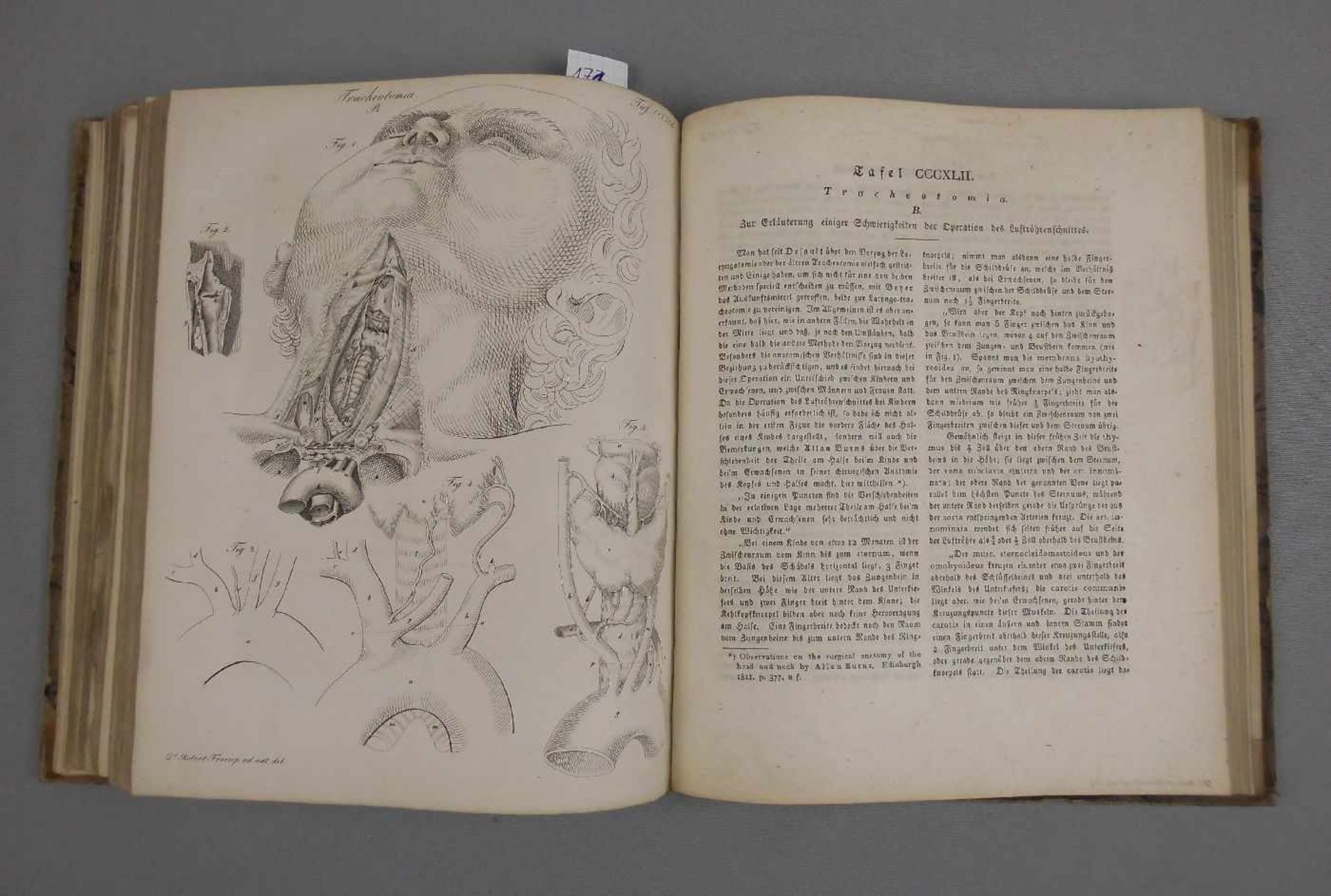 MEDIZINISCHES LEHRBUCH VON 1826 MIT CHIRURGISCHEN KUPFERTAFELN / medical book: "Chirurgische - Image 14 of 14