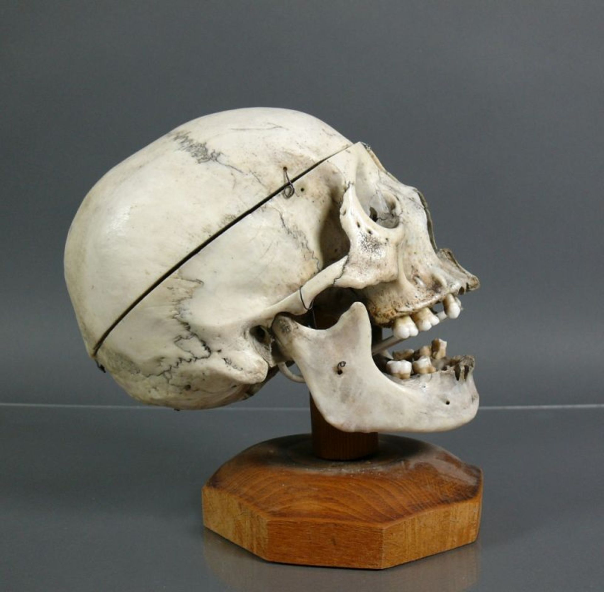 Anatomischer Schädelauf Holzsockel; H: ca. 21 cm - Bild 3 aus 3