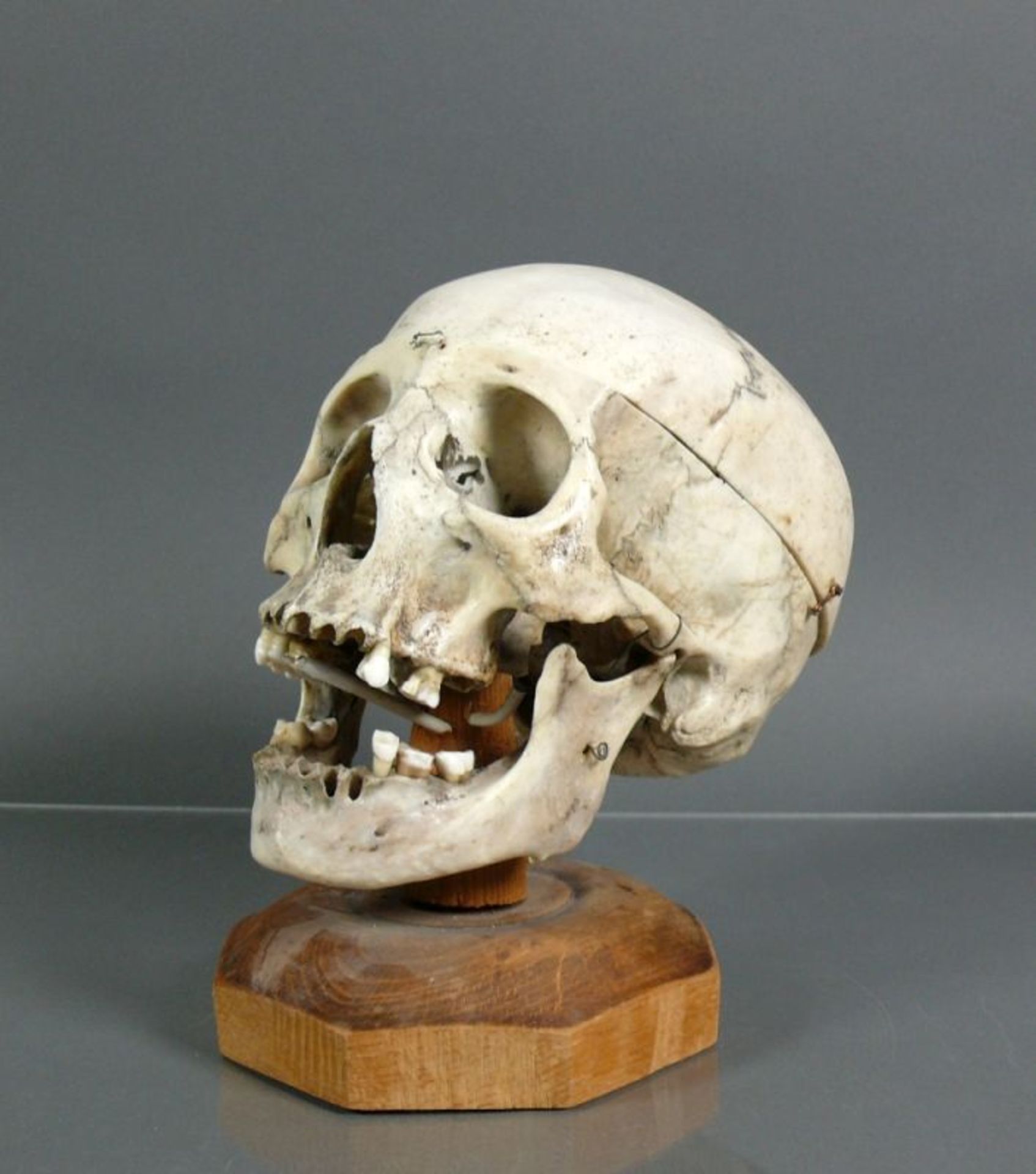 Anatomischer Schädelauf Holzsockel; H: ca. 21 cm