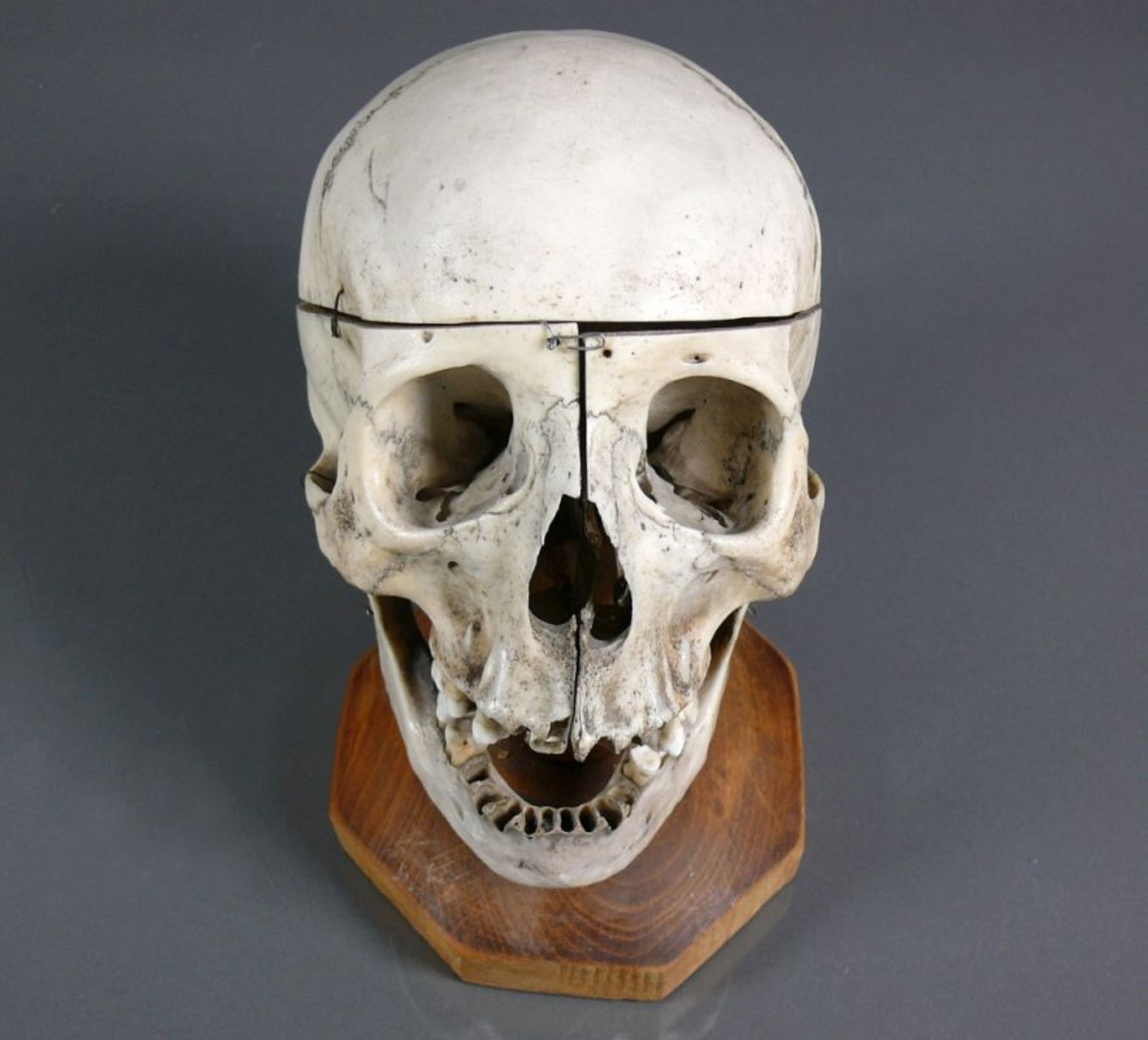 Anatomischer Schädelauf Holzsockel; H: ca. 21 cm - Bild 2 aus 3