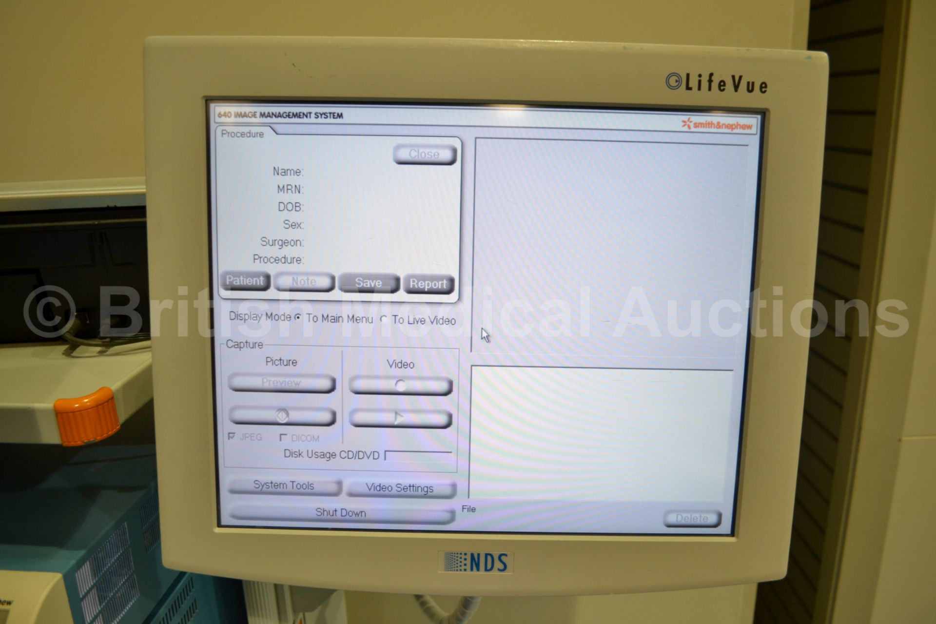 Smith&Nephew Endoscopy Stack System with Smith&Nep - Image 3 of 3