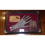 A cased mummy's hand, side show fairground attraction, 31cm x 20cm x 8cm.
