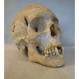 A student's medical research human skull with a hinged cut cross section top bears a paper label