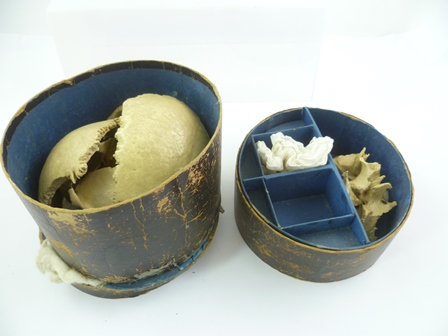 AN EARLY 20TH CENTURY ANATOMICAL HUMAN SKULL IN PIECES, including lower jaw with gold filled