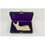 Atonomic Dentistry Lower Jaw Model In Fitted Case, Unmarked, Probably German,