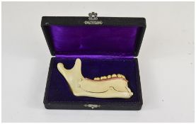Atonomic Dentistry Lower Jaw Model In Fitted Case, Unmarked, Probably German,
