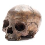 A 19th century human skull together with a later 20th century composition skeleton:,