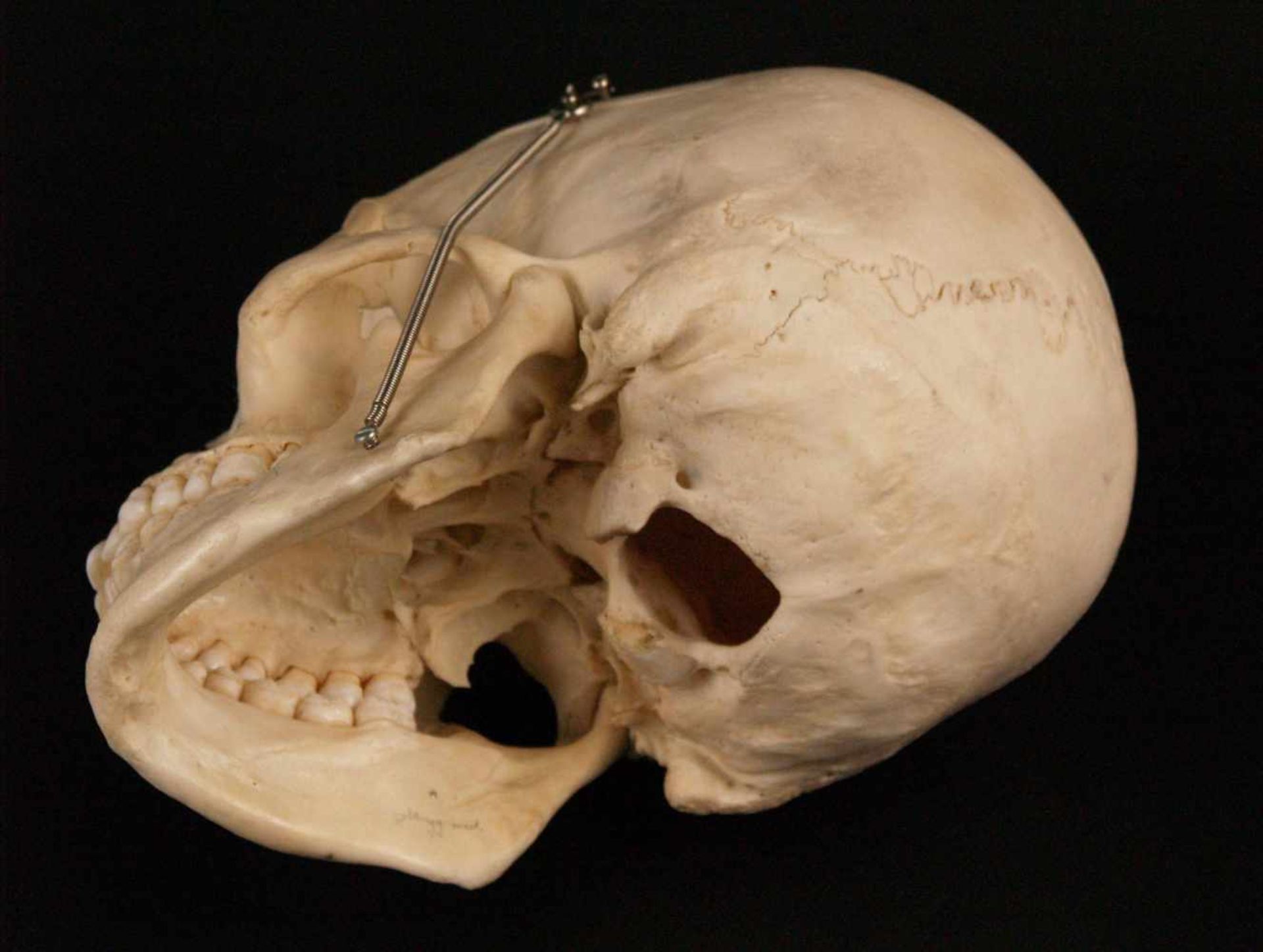 Mediziner-Schädel - anatomisch korrekte Replik eines menschlichen Schädels, Kalotte abnehmbar, - Bild 4 aus 4