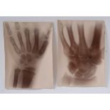 A group of five very early and rare x-ray photographs, one inscribed verso in pencil The Right Hand,