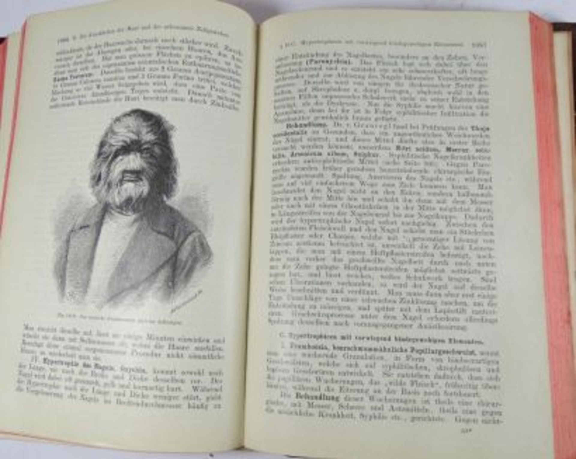 "Lehrbuch der homöopathischen Therapie" 1906, Band I - Bild 4 aus 5