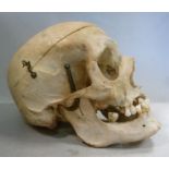 An early 20thC human skull (for medical students' use)