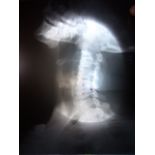 Two Traditional X Ray Pictures of Human Skull and Vertebrae.