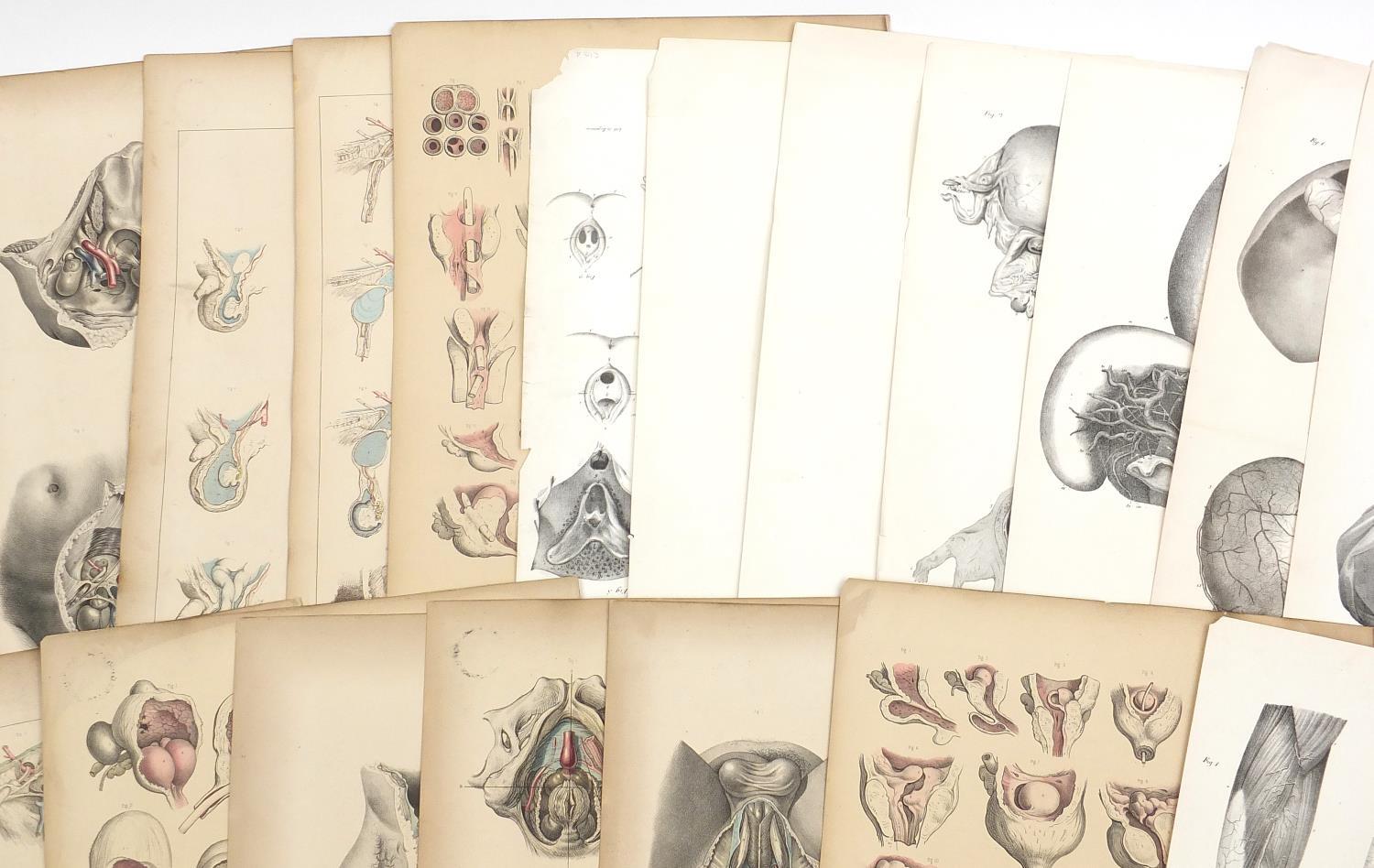 Portfolio of antique anatomical engravings, some coloured, each 53cm x 35cm : For further - Image 3 of 8