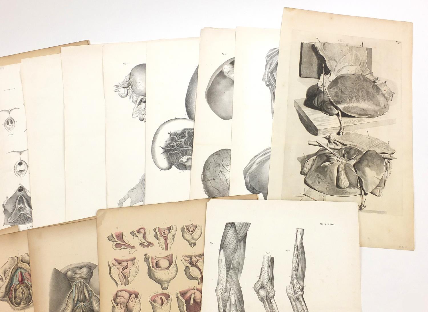 Portfolio of antique anatomical engravings, some coloured, each 53cm x 35cm : For further - Image 4 of 8