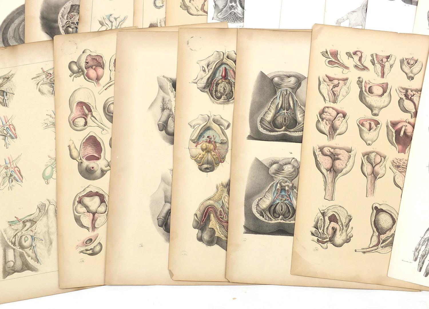 Portfolio of antique anatomical engravings, some coloured, each 53cm x 35cm : For further - Image 6 of 8