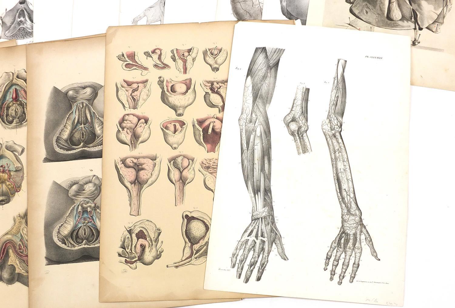 Portfolio of antique anatomical engravings, some coloured, each 53cm x 35cm : For further - Image 7 of 8