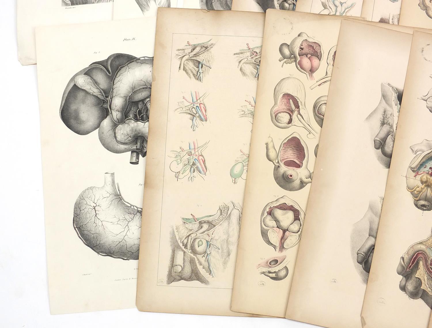 Portfolio of antique anatomical engravings, some coloured, each 53cm x 35cm : For further - Image 5 of 8