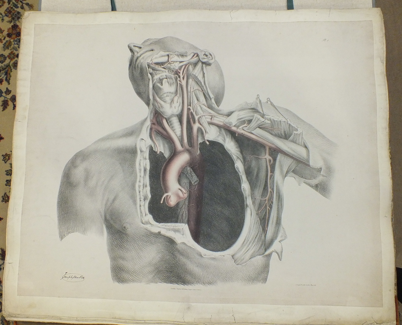 Quain (Richard), The Anatomy of the Arteries of the Human Body with its Applications to Pathology - Image 2 of 4