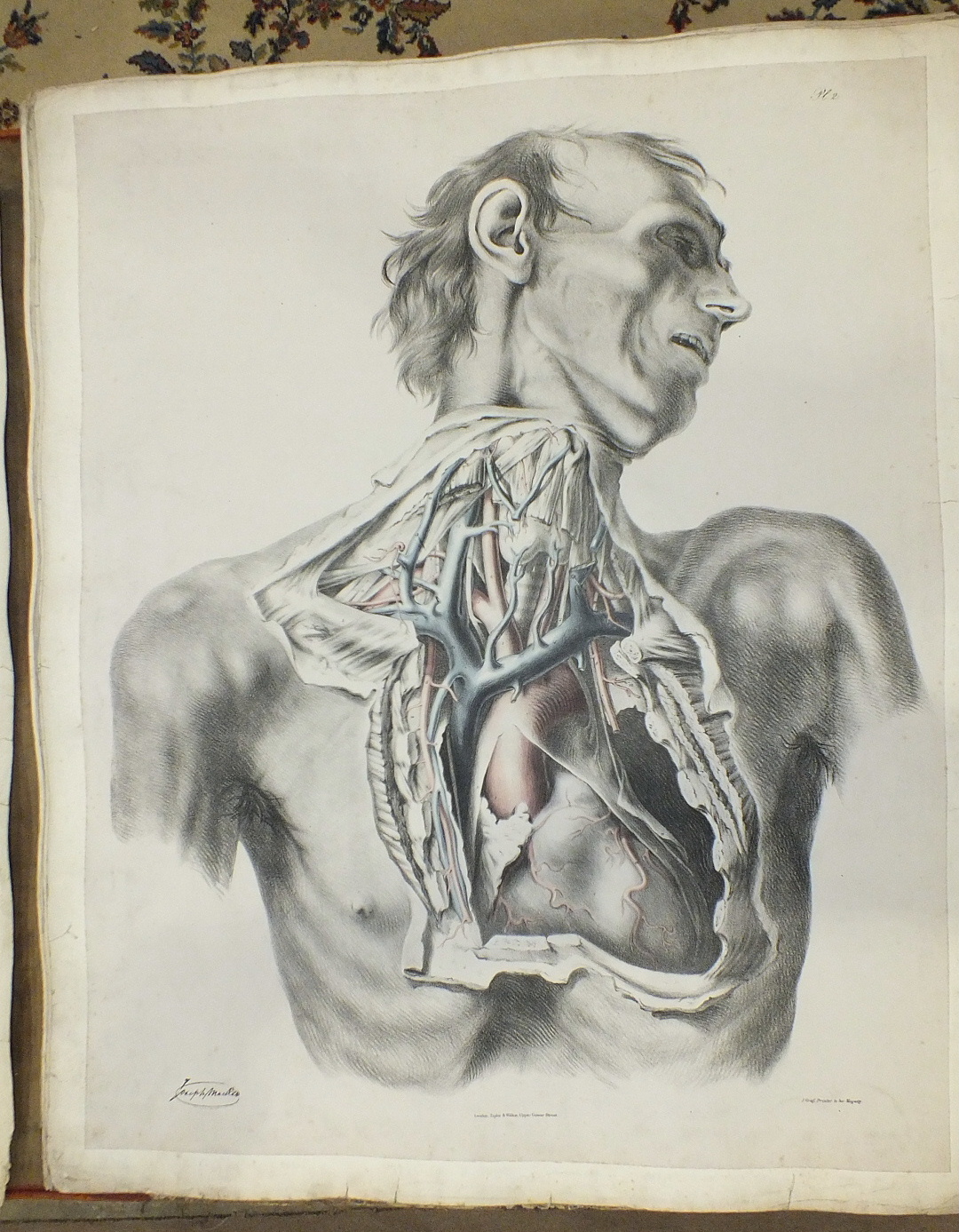 Quain (Richard), The Anatomy of the Arteries of the Human Body with its Applications to Pathology