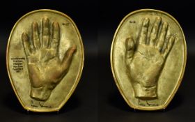 Medical Interest Limited Edition Cast Bronze Impression Of Dr Chris Barnard's Hands On 3 December