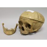 A human anatomical skull