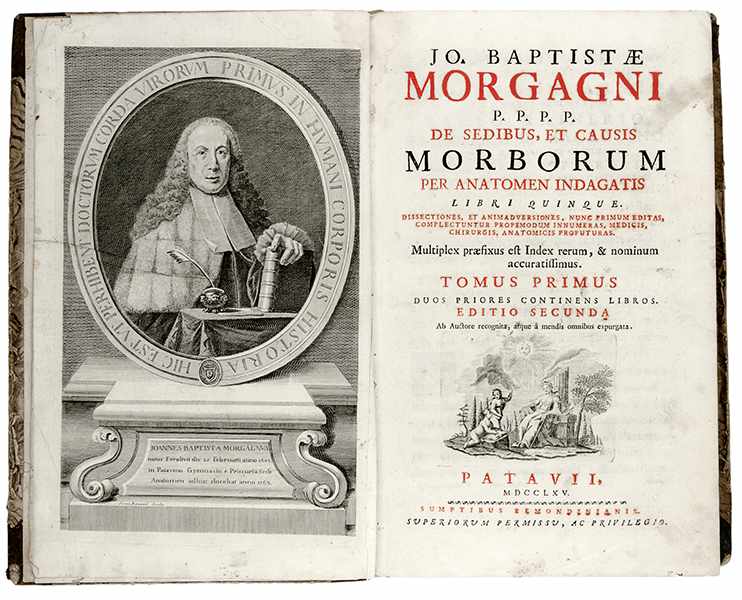 Medizin - Anatomie - - Morgagni, Giovanni Battista. De sedibus, et causis morborum per anatomen