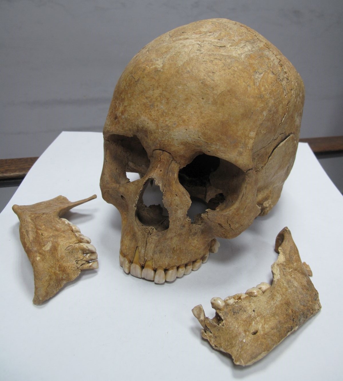 A Skull, with detached mandible.