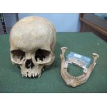 A Skull, and mandible, etc.