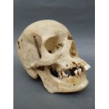 A male human skull labelled with anatomical regions, with articulating jaw and removable top.