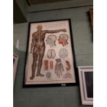 Framed medical chart.