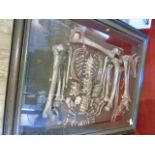 Cased set of reproduction human skeleton bones