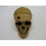 Human skull - early medical skull, top hinged and removed - trepanned