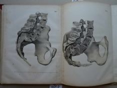 Kilian, H.F.Armamentarium Lucinae novum oder Umfassende Sammlung von Abbildungen der in der