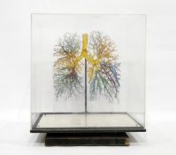 20th century resin model of the blood vessels in the lungs,